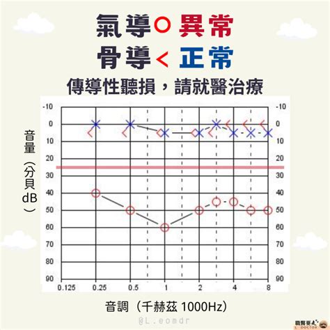 噪音符號|聽力圖判讀：基礎篇 – 職醫要走